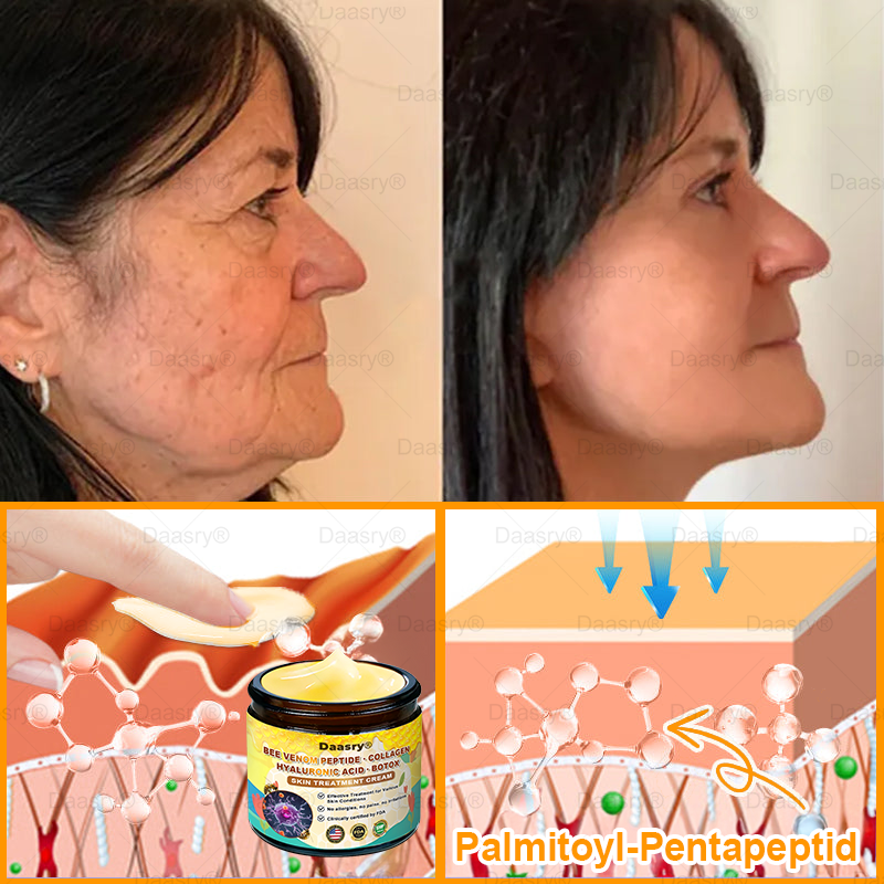 🔥𝑴𝒂𝒅𝒆 & 𝑺𝒉𝒊𝒑𝒑𝒆𝒅 𝒇𝒓𝒐𝒎 𝑼𝑺𝑨 | 𝑪𝒍𝒊𝒏𝒊𝒄𝒂𝒍𝒍𝒚 𝑷𝒓𝒐𝒗𝒆𝒏: ᴅᴀᴀsʀʏ® 𝑩𝒆𝒆 𝑽𝒆𝒏𝒐𝒎 𝑻𝒓𝒆𝒂𝒕𝒎𝒆𝒏𝒕 𝑪𝒓𝒆𝒂𝒎 𝒘𝒊𝒕𝒉 𝒃𝒆𝒆 𝒗𝒆𝒏𝒐𝒎 𝒑𝒆𝒑𝒕𝒊𝒅𝒆𝒔, 𝒃𝒐𝒕𝒖𝒍𝒊𝒏𝒖𝒎 𝒕𝒐𝒙𝒊𝒏, 𝒉𝒚𝒂𝒍𝒖𝒓𝒐𝒏𝒊𝒄 𝒂𝒄𝒊𝒅, 𝒂𝒏𝒅 𝒄𝒐𝒍𝒍𝒂𝒈𝒆𝒏💧. 𝑻𝒂𝒓𝒈𝒆𝒕𝒔 𝒘𝒓𝒊𝒏𝒌𝒍𝒆𝒔, 𝒇𝒊𝒏𝒆 𝒍𝒊𝒏𝒆𝒔, 𝒔𝒂𝒈𝒈𝒊𝒏𝒈, 𝒔𝒕𝒓𝒆𝒕𝒄𝒉 𝒎𝒂𝒓𝒌𝒔, 𝒅𝒂𝒓𝒌 𝒔𝒑𝒐𝒕𝒔—𝒇𝒊𝒓𝒎𝒊𝒏𝒈, 𝒍𝒊𝒇𝒕𝒊𝒏𝒈 𝒂𝒏𝒅 𝒎𝒐𝒓𝒆