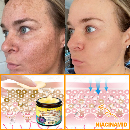 🔥𝑴𝒂𝒅𝒆 & 𝑺𝒉𝒊𝒑𝒑𝒆𝒅 𝒇𝒓𝒐𝒎 𝑼𝑺𝑨 | 𝑪𝒍𝒊𝒏𝒊𝒄𝒂𝒍𝒍𝒚 𝑷𝒓𝒐𝒗𝒆𝒏: ᴅᴀᴀsʀʏ® 𝑩𝒆𝒆 𝑽𝒆𝒏𝒐𝒎 𝑻𝒓𝒆𝒂𝒕𝒎𝒆𝒏𝒕 𝑪𝒓𝒆𝒂𝒎 𝒘𝒊𝒕𝒉 𝒃𝒆𝒆 𝒗𝒆𝒏𝒐𝒎 𝒑𝒆𝒑𝒕𝒊𝒅𝒆𝒔, 𝒃𝒐𝒕𝒖𝒍𝒊𝒏𝒖𝒎 𝒕𝒐𝒙𝒊𝒏, 𝒉𝒚𝒂𝒍𝒖𝒓𝒐𝒏𝒊𝒄 𝒂𝒄𝒊𝒅, 𝒂𝒏𝒅 𝒄𝒐𝒍𝒍𝒂𝒈𝒆𝒏💧. 𝑻𝒂𝒓𝒈𝒆𝒕𝒔 𝒘𝒓𝒊𝒏𝒌𝒍𝒆𝒔, 𝒇𝒊𝒏𝒆 𝒍𝒊𝒏𝒆𝒔, 𝒔𝒂𝒈𝒈𝒊𝒏𝒈, 𝒔𝒕𝒓𝒆𝒕𝒄𝒉 𝒎𝒂𝒓𝒌𝒔, 𝒅𝒂𝒓𝒌 𝒔𝒑𝒐𝒕𝒔—𝒇𝒊𝒓𝒎𝒊𝒏𝒈, 𝒍𝒊𝒇𝒕𝒊𝒏𝒈 𝒂𝒏𝒅 𝒎𝒐𝒓𝒆