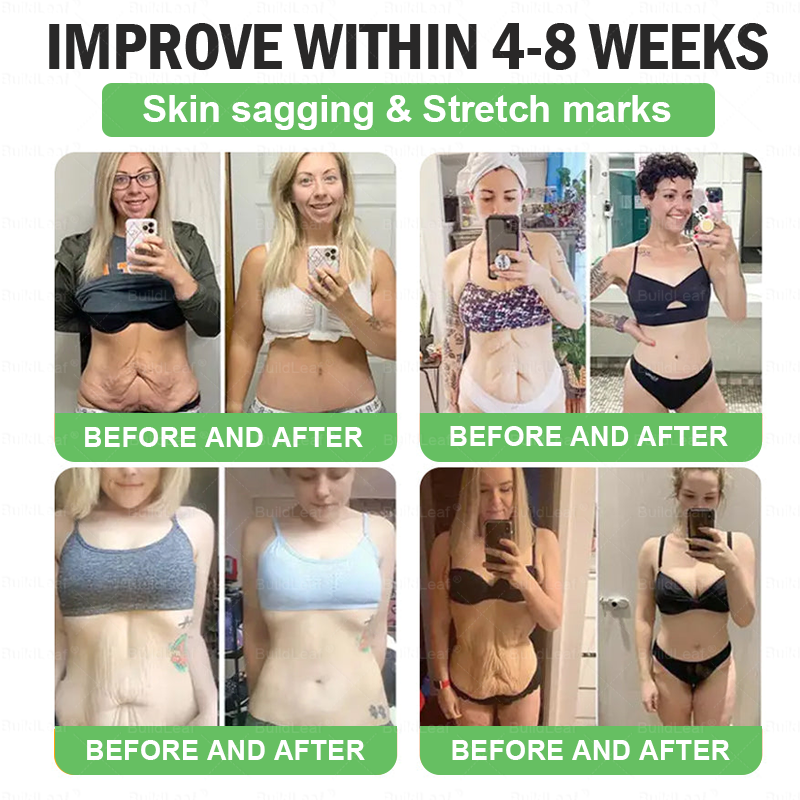 🌍💪𝑶𝒇𝒇𝒊𝒄𝒊𝒂𝒍 𝑺𝒕𝒐𝒓𝒆 | 𝑩𝒖𝒊𝒍𝒅𝑳𝒆𝒂𝒇®𝐁𝐞𝐫𝒃𝒆𝒓𝒊𝒏𝒆 & 𝐆𝐋𝐏-𝟏 𝑷𝒓𝒐 𝑾𝒆𝒊𝒈𝒉𝒕 𝑳𝒐𝒔𝒔 𝑶𝒓𝒂𝒍 𝑺𝒐𝒍𝒖𝒕𝒊𝒐𝒏 𝗍𝖺𝗋𝗀𝖾𝗍𝗌 𝑡𝑢𝑏𝑏𝑜𝑟𝑛 𝑤𝑒𝑖𝑔ℎ𝑡, ℎ𝑖𝑔ℎ 𝑏𝑙𝑜𝑜𝑑 𝑝𝑟𝑒𝑠𝑠𝑢𝑟𝑒, 𝑏𝑙𝑜𝑜𝑑 𝑠𝑢𝑔𝑎𝑟 ,𝘧𝘢𝘵𝘵𝘺 𝘭𝘪𝘷𝘦𝘳, 𝘫𝘰𝘪𝘯𝘵 𝘱𝘢𝘪𝘯, 𝘧𝘢𝘵𝘪𝘨𝘶𝘦,𝑙𝑜𝑤 𝑒𝑛𝑒𝑟𝑔𝑦, 𝑠𝑎𝑔𝑔𝑖𝑛𝑔 𝑠𝑘𝑖𝑛 & 𝑚𝑜𝑟𝑒 𝑓𝑜𝑟 𝑏𝑒𝑡𝑡𝑒𝑟 ℎ𝑒𝑎𝑙𝑡ℎ & 𝑣𝑖𝑡𝑎𝑙𝑖𝑡𝑦