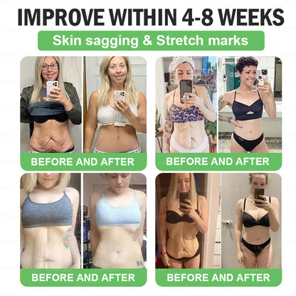 🌍💪𝑶𝒇𝒇𝒊𝒄𝒊𝒂𝒍 𝑺𝒕𝒐𝒓𝒆 | 𝑩𝒖𝒊𝒍𝒅𝑳𝒆𝒂𝒇®𝐁𝐞𝐫𝒃𝒆𝒓𝒊𝒏𝒆 & 𝐆𝐋𝐏-𝟏 𝑷𝒓𝒐 𝑾𝒆𝒊𝒈𝒉𝒕 𝑳𝒐𝒔𝒔 𝑶𝒓𝒂𝒍 𝑺𝒐𝒍𝒖𝒕𝒊𝒐𝒏 𝗍𝖺𝗋𝗀𝖾𝗍𝗌 𝑡𝑢𝑏𝑏𝑜𝑟𝑛 𝑤𝑒𝑖𝑔ℎ𝑡, ℎ𝑖𝑔ℎ 𝑏𝑙𝑜𝑜𝑑 𝑝𝑟𝑒𝑠𝑠𝑢𝑟𝑒, 𝑏𝑙𝑜𝑜𝑑 𝑠𝑢𝑔𝑎𝑟 ,𝘧𝘢𝘵𝘵𝘺 𝘭𝘪𝘷𝘦𝘳, 𝘫𝘰𝘪𝘯𝘵 𝘱𝘢𝘪𝘯, 𝘧𝘢𝘵𝘪𝘨𝘶𝘦,𝑙𝑜𝑤 𝑒𝑛𝑒𝑟𝑔𝑦, 𝑠𝑎𝑔𝑔𝑖𝑛𝑔 𝑠𝑘𝑖𝑛 & 𝑚𝑜𝑟𝑒 𝑓𝑜𝑟 𝑏𝑒𝑡𝑡𝑒𝑟 ℎ𝑒𝑎𝑙𝑡ℎ & 𝑣𝑖𝑡𝑎𝑙𝑖𝑡𝑦